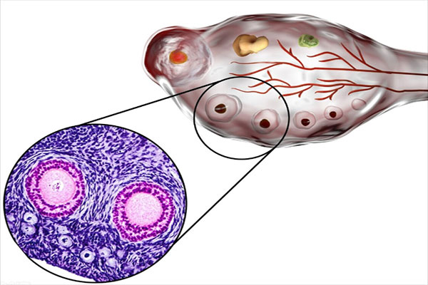試管嬰兒促排期間注意事項有哪些呢？