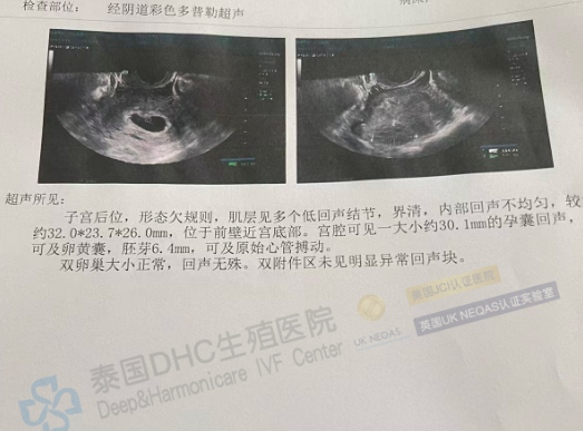 泰國DHC好孕檔案0919：從攻克46%精子碎片率，到見證7周健康心跳