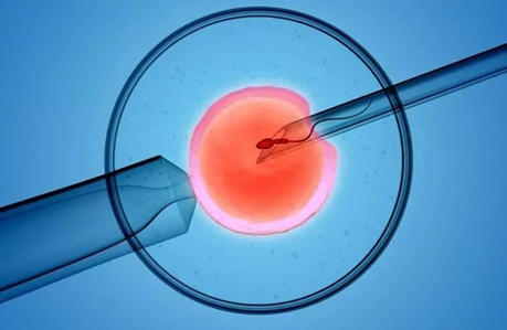 人工授精 人工授精