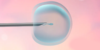 什么是泰國試管嬰兒取卵、取精？