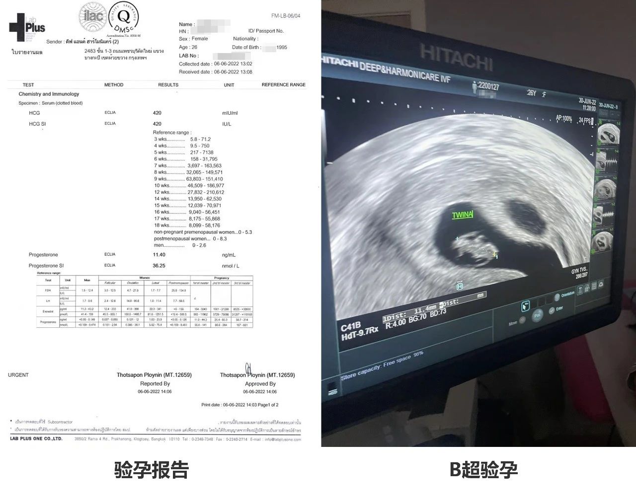 40e87f7b734613bce04f6f50746d12fa 40e87f7b734613bce04f6f50746d12fa