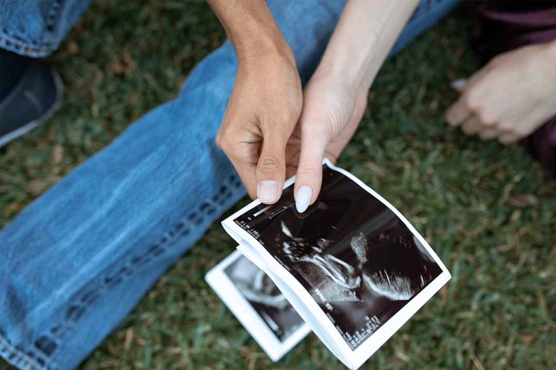 夫婦和檢查 夫婦和檢查