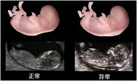 圖片4_50%.png 圖片4_50%.png