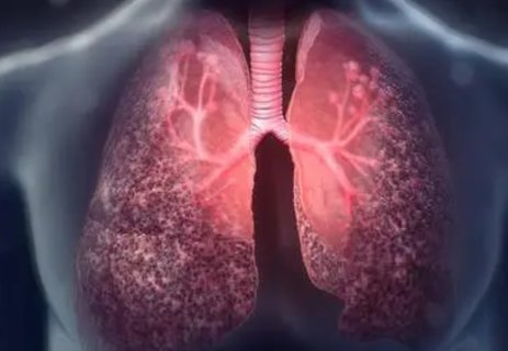 囊性纖維化會遺傳給后代嗎？囊性纖維化遺傳方式