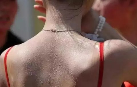 夏天出汗對身體有好處嗎？夏天出汗的十大驚人好處