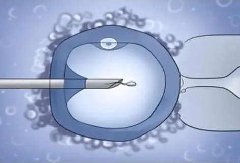 無精癥怎么恢復生精功能？無精癥的調理治療方法