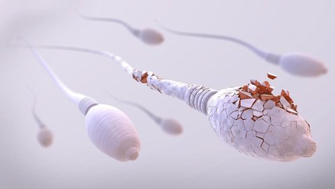 無精癥有什么具體的表現？無精癥的十大表現