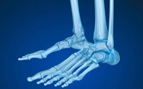 骨折好轉的跡象有哪些？骨折好轉的四個跡象