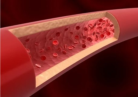 雙側輸卵管堵塞能自愈嗎？雙側輸卵管堵塞還能懷孕嗎？