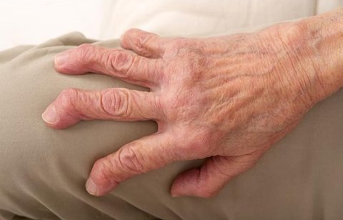 怎樣緩解類風濕疼痛？緩解類風濕性關(guān)節(jié)炎的方法