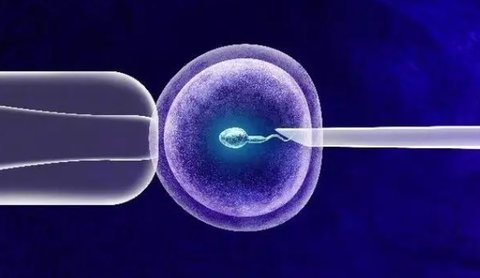 人工授精和試管哪個成功率高？人工授精和試管如何選擇？