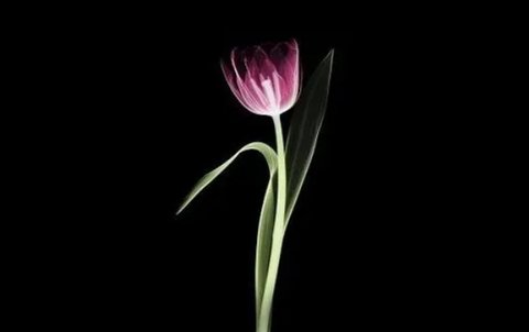 試管嬰兒是怎么做的全部過程？試管嬰兒的具體步驟