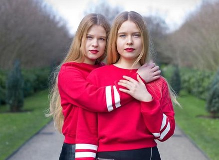 同卵雙胎和異卵雙胎哪種比較常見？同卵雙胎和異卵雙胎的區別