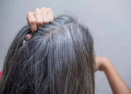 6類(lèi)人容易提前長(zhǎng)白發(fā)！探索原因與預(yù)防策略