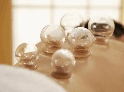 "男不刮痧女不拔罐"是什么意思：傳統(tǒng)中醫(yī)養(yǎng)生理念解析