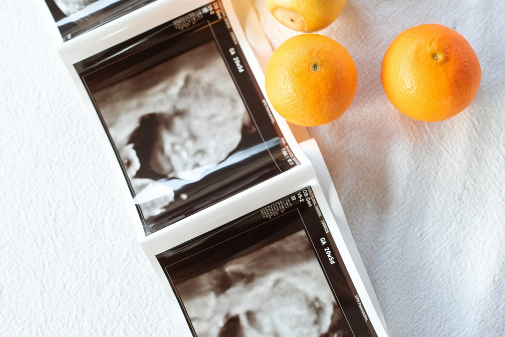 結婚三年沒懷孕正常嗎？多年未孕的原因