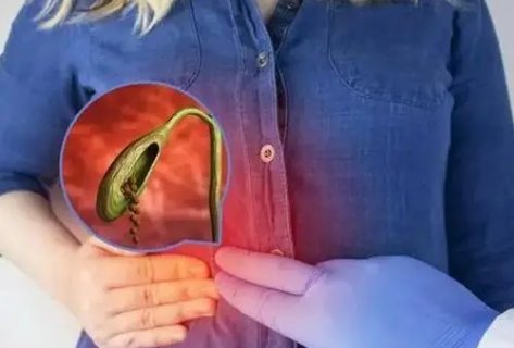 女人切除膽囊后是不是老得快？女人切除膽囊對身體的影響