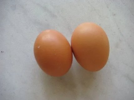 睪丸囊腫會自己消失嗎？了解其自然進程與治療選項