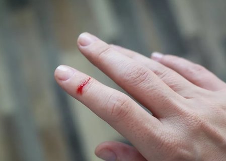 破傷風(fēng)早期有哪些癥狀？破傷風(fēng)早期的6個(gè)征兆