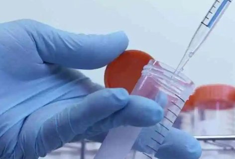 拮抗劑方案具體流程是什么？試管拮抗劑方案流程步驟