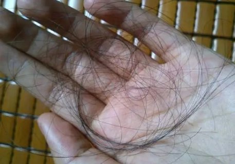 掉頭發的主要原因有哪些？掉頭發其實就2個原因