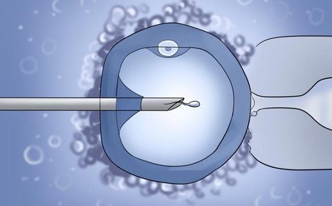 卵泡穿刺就會排卵嗎？解析卵泡穿刺與排卵的關系