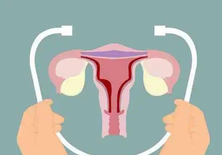 TCT檢查報告單怎么看？TCT檢查的意義和作用