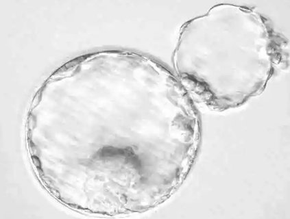 輔助孵化能提高成功率嗎？揭秘輔助孵化技術的影響