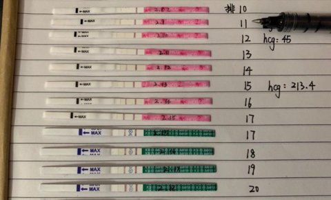 打HCG后12小時與48小時試紙檢測的區別