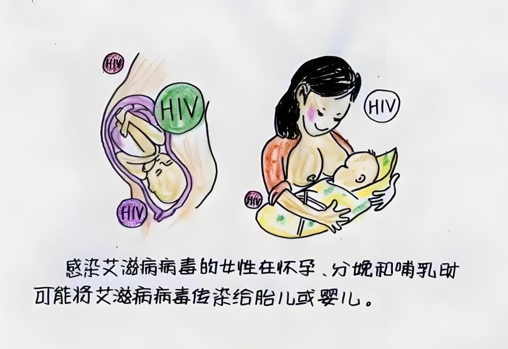 艾滋病傳播方式 艾滋病傳播方式