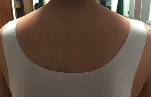 為什么越開肩反而越內扣？肩膀內扣開肩的作用