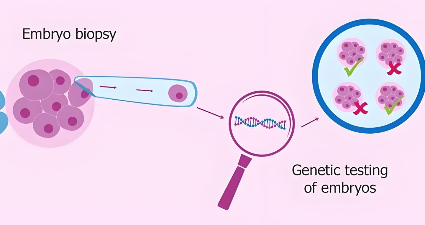 胚胎篩選 胚胎篩選