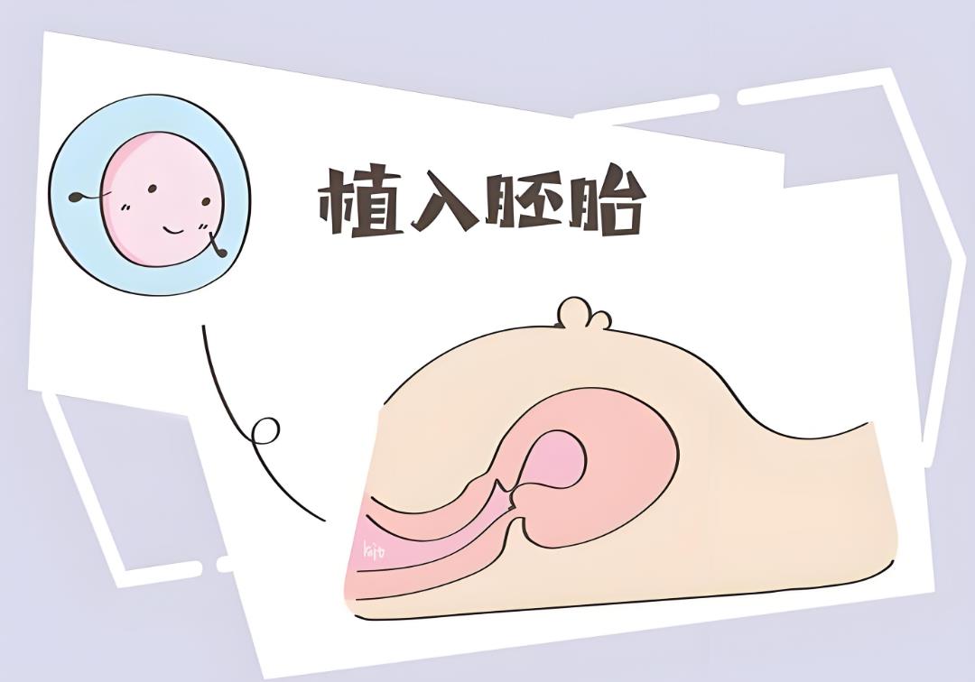 胚胎移植 胚胎移植