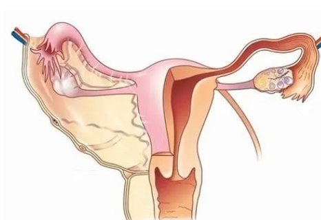 沒(méi)有輸卵管可以做試管嗎？試管嬰兒技術(shù)解決問(wèn)題