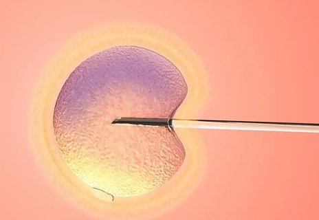 試管移植囊胚幾天著床？移植囊胚著床所需時間