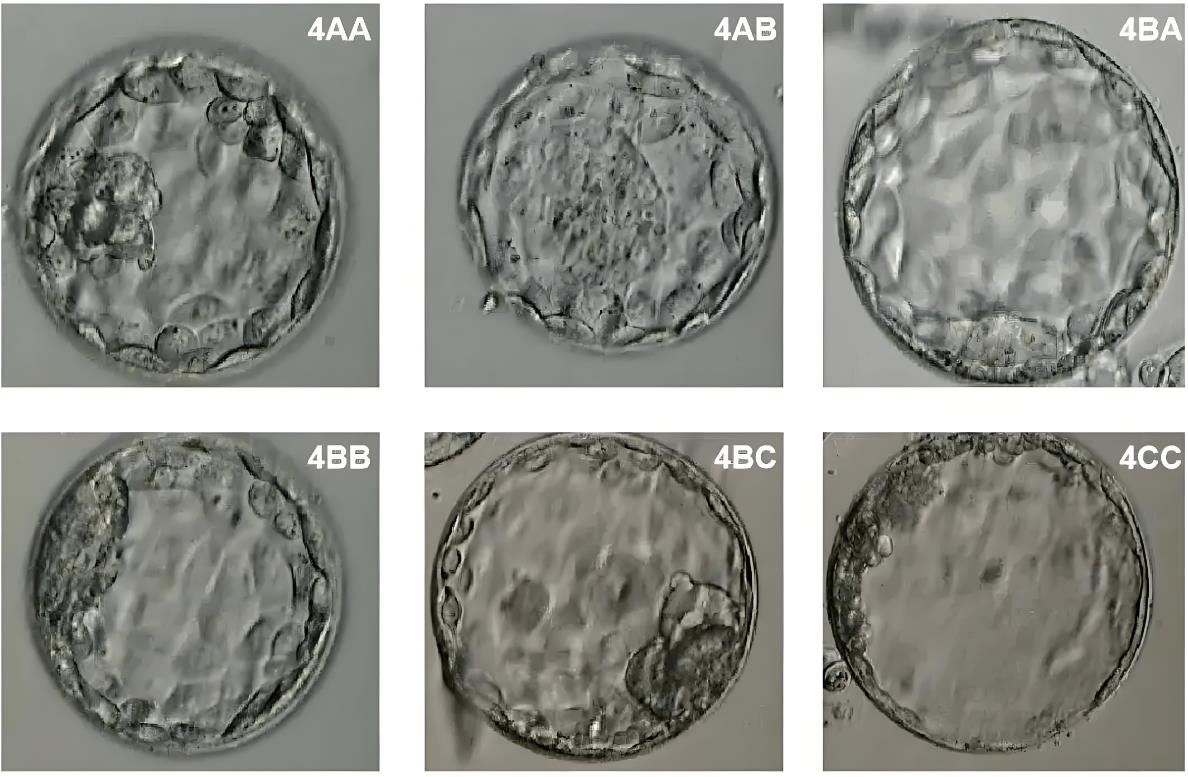 泰國試管看囊胚級別嗎,如何提高囊胚質量