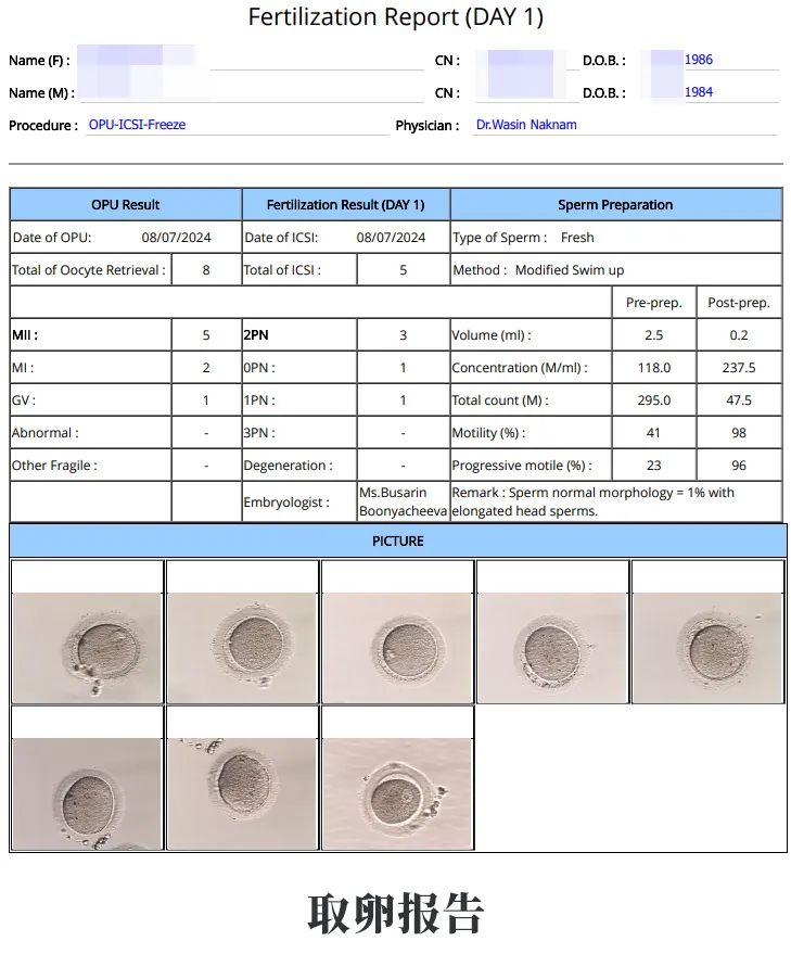 取卵報告 取卵報告