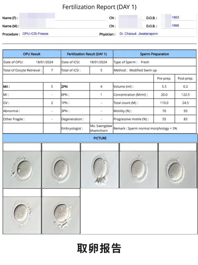 取卵報告 取卵報告