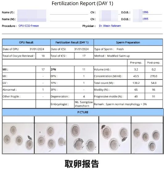 取卵報告 取卵報告