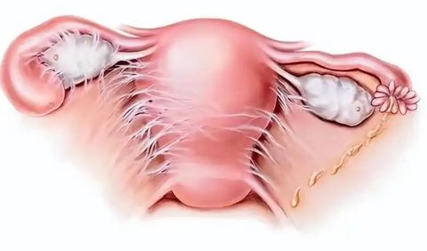 宮腔粘連對移植有影響嗎？宮腔粘連對試管嬰兒移植的影響