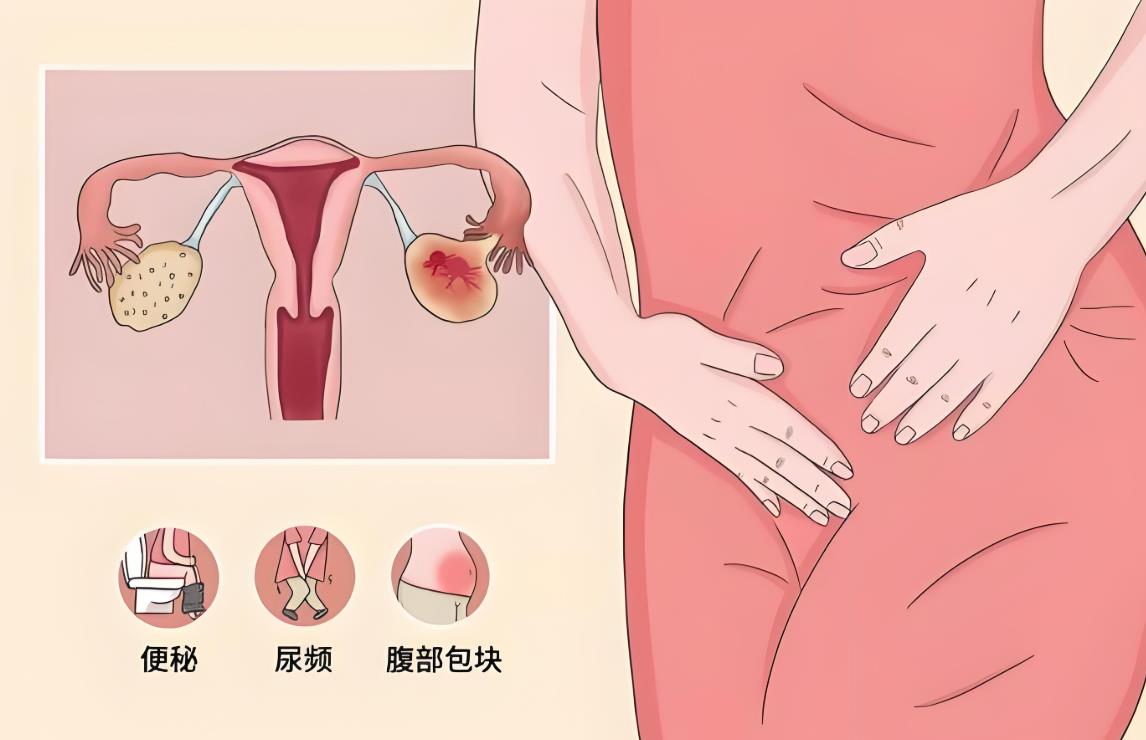 卵巢功能 卵巢功能