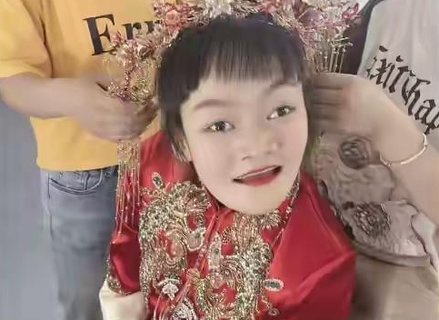 腦癱女孩嫁唐氏丈夫！問題父母能否生出健康孩子？