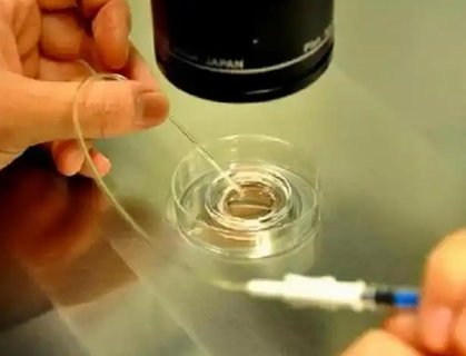 三代試管可以避免畸形嗎？避免畸形的希望與現實