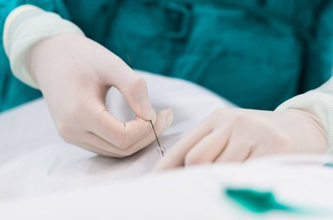 試管減胎對另一個有影響嗎？對另一胎兒的潛在影響