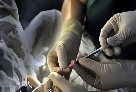 去泰國做試管流程是怎樣的？泰國試管的詳細(xì)過程