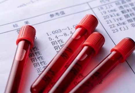 β人絨毛膜促性腺激素多少是懷孕？懷孕的標志
