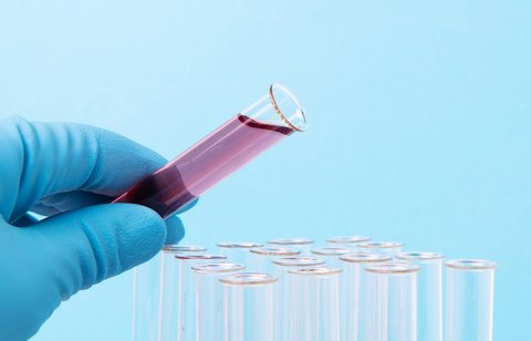 去泰國做試管好不好？三代技術是否更值得？