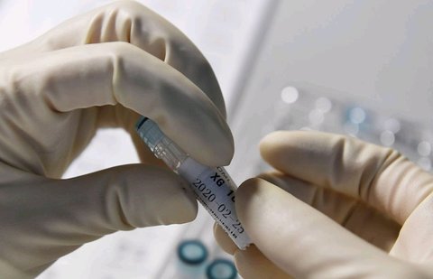 脂聯素偏低是什么原因怎么調理？調理策略分析