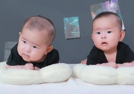 減胎風險大還是懷雙胎風險大？風險對比與選擇