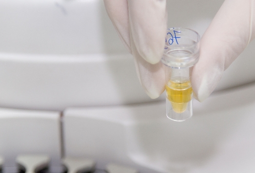 重慶試管嬰兒費用大約多少？2025重慶費用分析